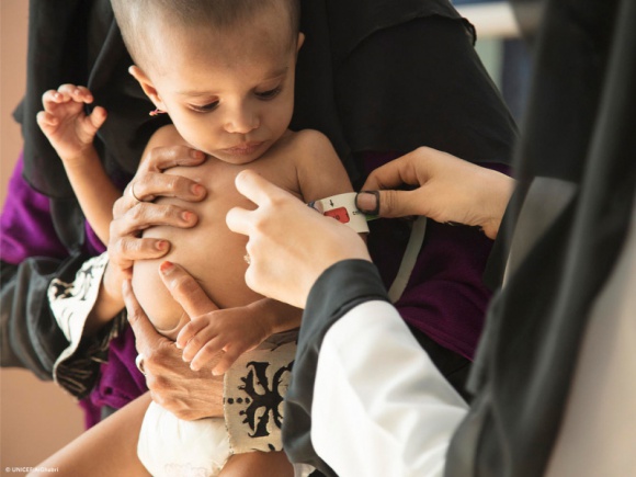 80% dzieci w Jemenie wymaga pomocy humanitarnej. Najmłodsi umierają z głodu Problemy społeczne, BIZNES - 80% wszystkich dzieci w Jemenie, wymaga pomocy humanitarnej. Niemal 400 tysięcy z nich cierpi na skutek ciężkiego ostrego niedożywienia i walczy o życie. UNICEF Polska apeluje o pomoc i prosi o wsparcie dzieci w tym kraju. Pomóc można poprzez stronę unicef.pl/jemen.